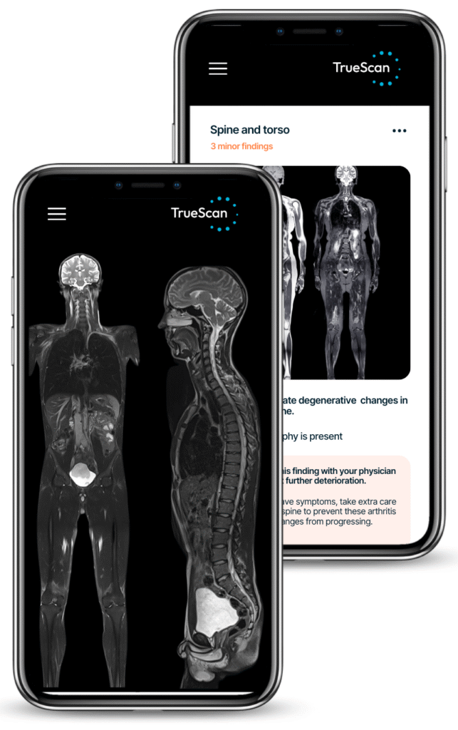 MRI scan results displayed on-screen for early detection at Griffin Concierge Medical in partnership with TrueScan in St. Petersburg, FL.